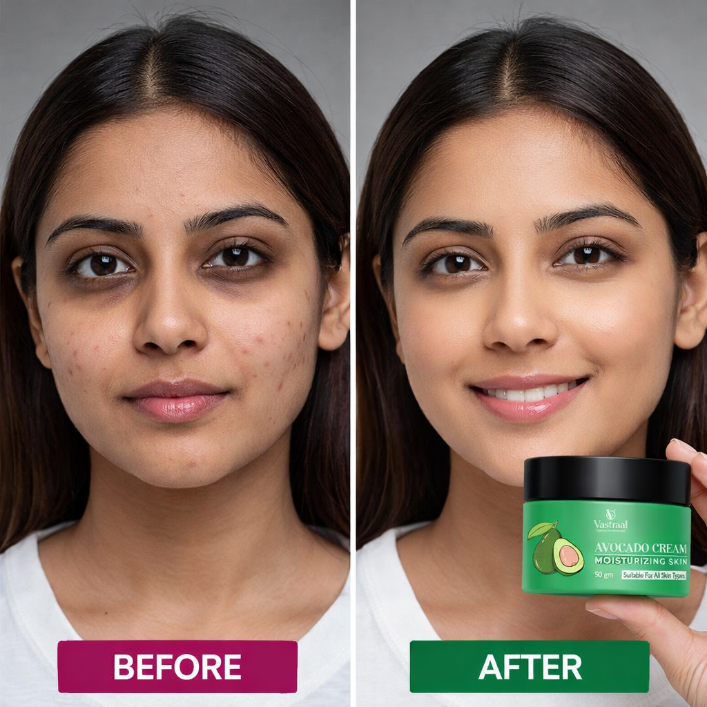 Avocado Moisturizing Skin Cream – Deep Hydration, Soft & Nourished Skin